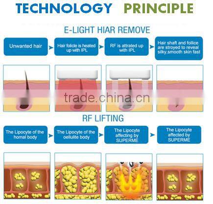 NEW technology High power hair removal e-light ipl rf nd yag laser multifunction machine