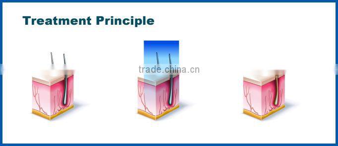 Best and most effective ipl laser beauty equipment for hair removal