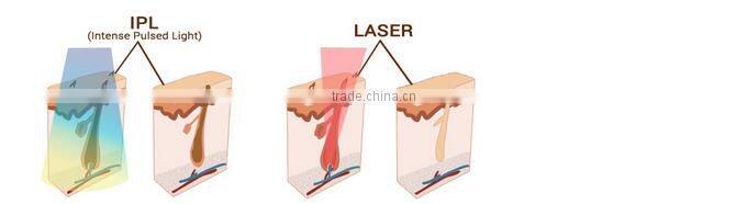 Double handles Elight IPL yag laser machine for hair removal and tattoo removal