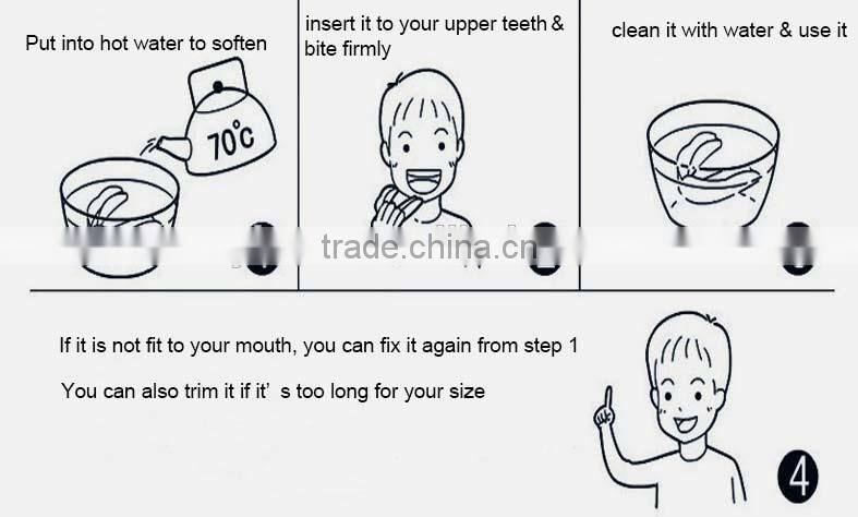 Boil & Bite Custom fit Mouthguard