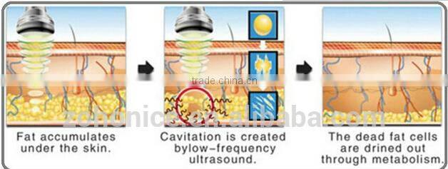 BD06C super RF vacuum with cryo Fat freezing sliming machine