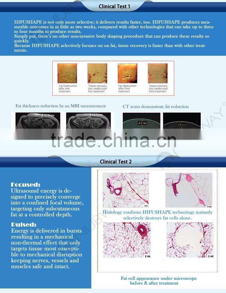 Beauty equipment 1-10 continuously adjustable cavitation slimming machine ultrasonic ultralift hifu