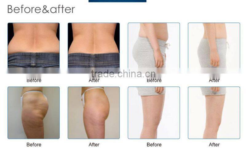 Plastic belt massager beauty slimming machine slimming capsule filling machine made in China