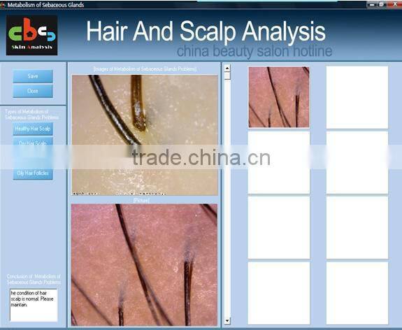 Collagen hair treatment skin and hair analyzer equipment beauty salon machine