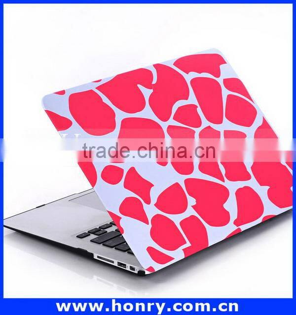 Top level Cheapest hard cover case for macbook air 11