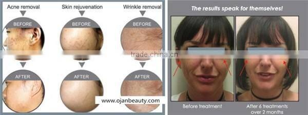 Professional medical led light therapy omnilux revive beauty machine