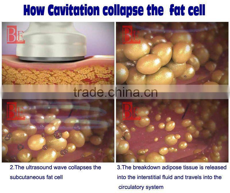 cavitation rf ultrasonic cavitation cavitation machine price