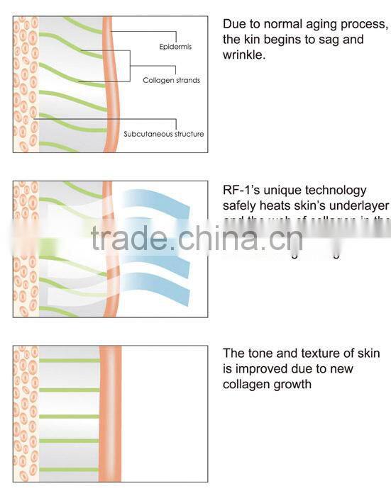 NL-RUV500 2015 New arrival Cavitation and rf / ultrasonic cavitation vacuum slimming machine