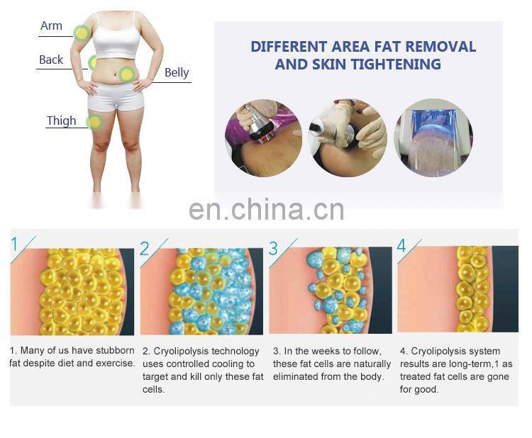 good quality product fat freeze weight loss function with RF and Cavitation slimming machine