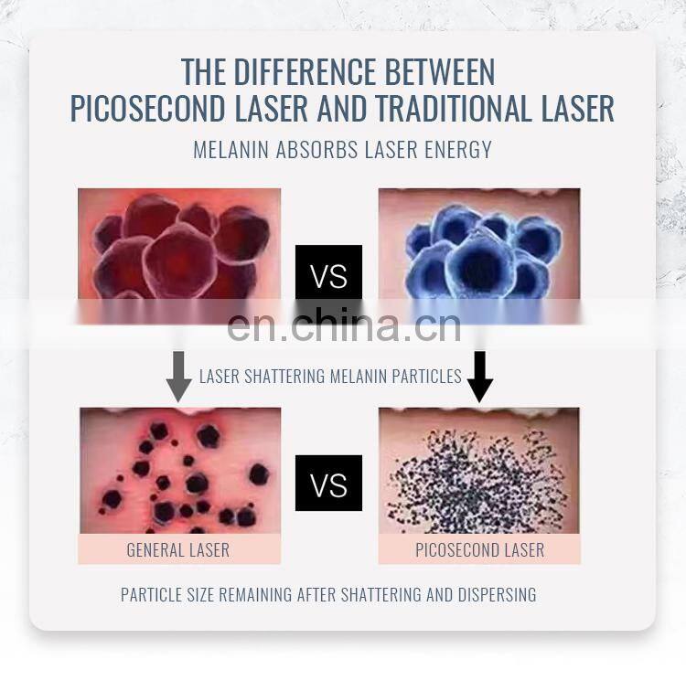 Professional Portable Picosecond Laser Tattoo Removal Machine Pico Laser Tattoo Remover Beauty Machine