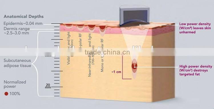 China supplier high intensity focused ultrasound slimming machine / liposunix slimming machine / fast slimming machine