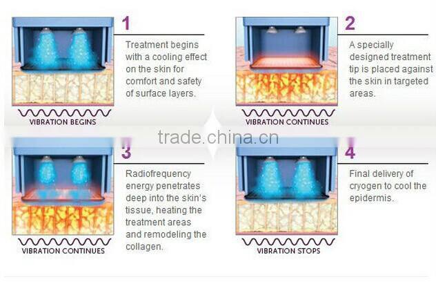 Best fractional rf machine for face lifting