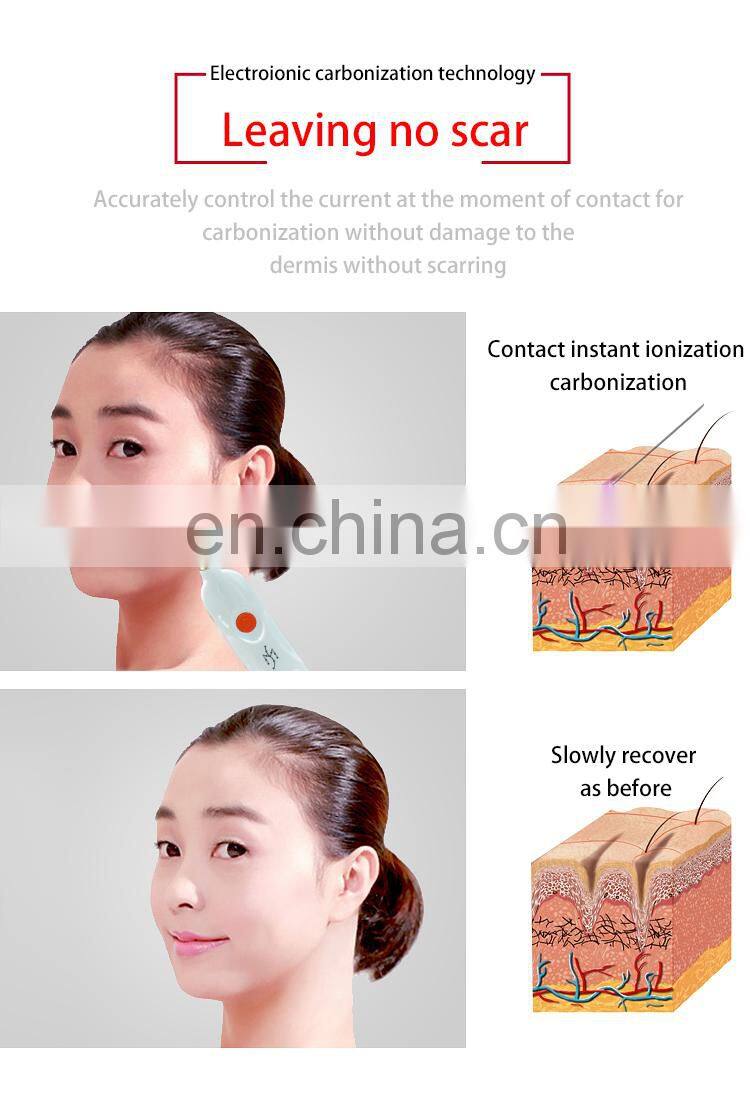 Handhold Skin Care Product Laser Mole Removal Pen Spot Removal Plasma Pen