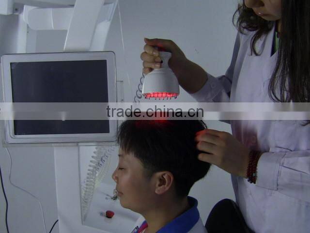 Top Sale 650nm Diode Laser Best Hair Regrowth Machine