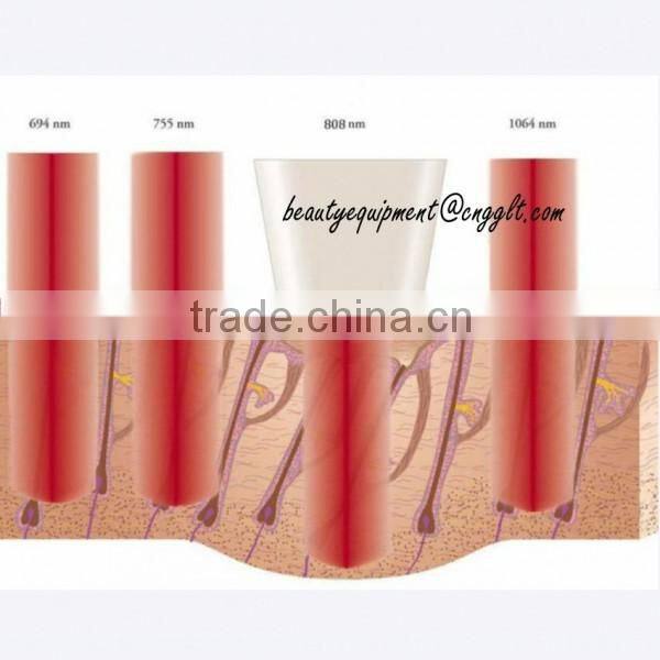 Germany 808nm diode laser hair removal