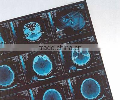 dry thermal film,dry x-ray film, dry imaging film