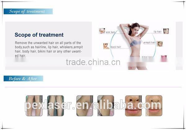 2016 Newest laser diodo 808 nm hair removal machine for salon use