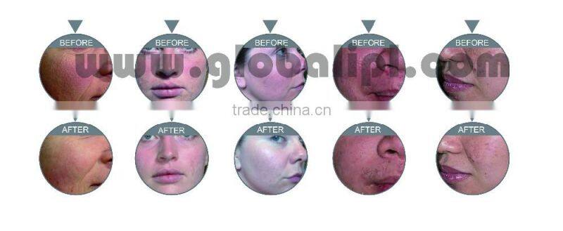 High quality medical oxygen filling machine with CE certificate