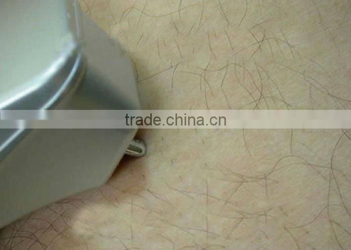 Mini laser hair removal home use device MB-P289