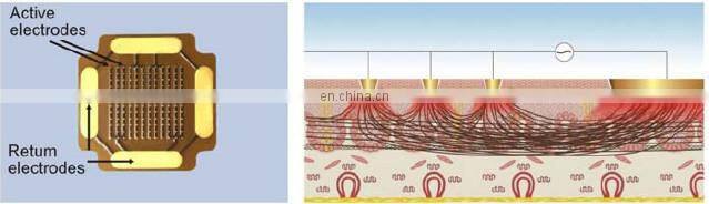 Fractional RF & Thermal RF 2 in 1 device face/body tightening /acne scars treatment GSD Dermatrix Pro
