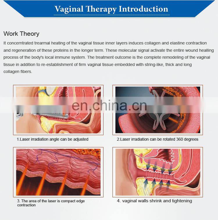 70W medical fractional co2 laser/co2 fractional laser/laser co2 fractional with CE
