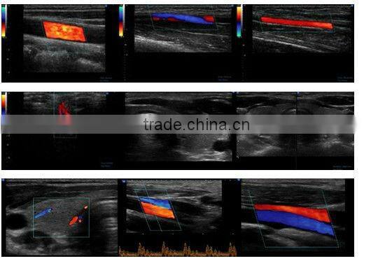 3D and 4D Color Doppler with 4D Real Time Live Probe iSpark 480plus/option Trans-vaginal Array Probe (180)