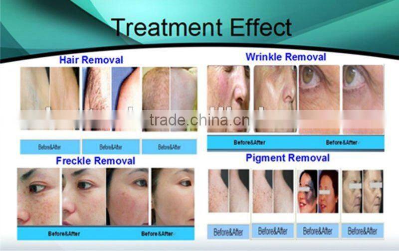 No hair!!! portable elight hair removal machine with CE&ISO