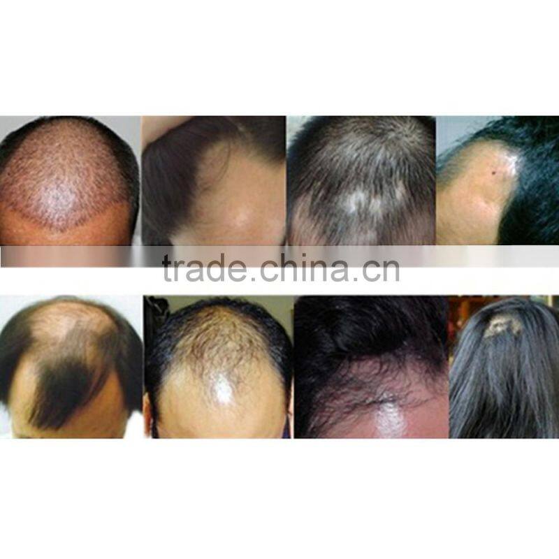 LCL2 Laser Hair Restoration Kit & Massage Loss Growth Comb Brush