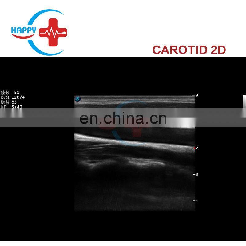 High specification Ultrasound color doppler/Sonoscape ultrasound/Sonoscape s12 4d color doppler ultrasound price