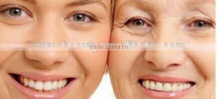 alexandrite laser 755nm hair removal equipment /Alex laser hair removal equipment