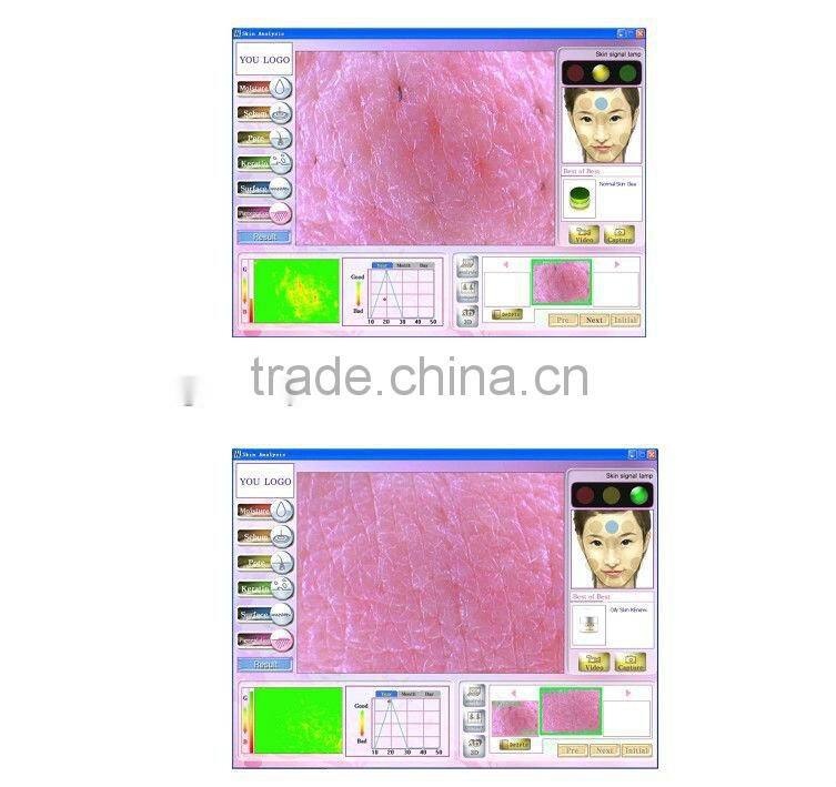 hot sale visia skin analysis machine HT-907