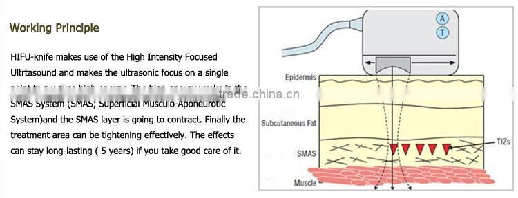 Medical CE Approved top quality 4 tips face lifting hifu korea OD-H6