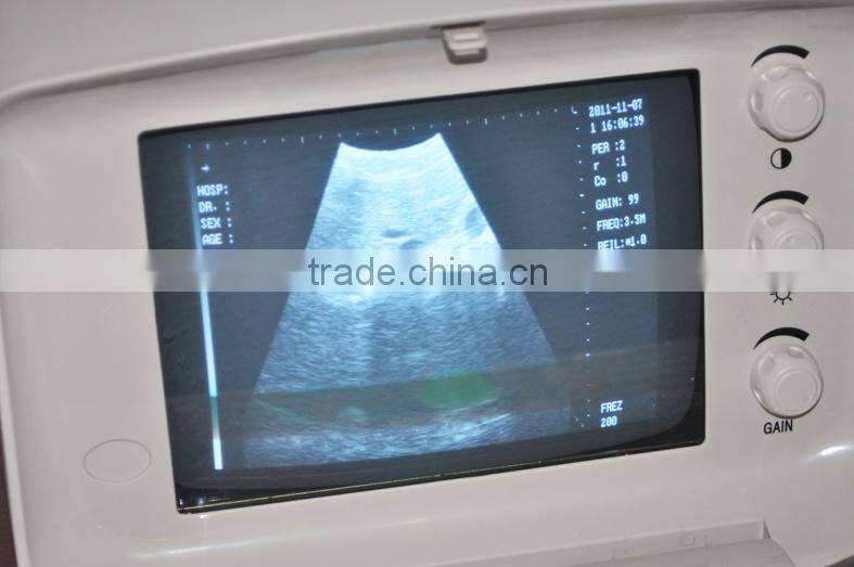 RUS-6000A Best Sale Hospital Clinic Portable Ultrasound Machine/Scanner with convex, transvaginal, linear, rectal probe-Shelly