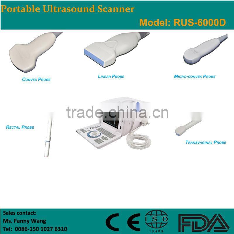 CE approved Portable B-Mode USB Ultrasonic/ Ultrasound Scanner with 3.5Mhz multi-frequency convex probe RUS-6000D