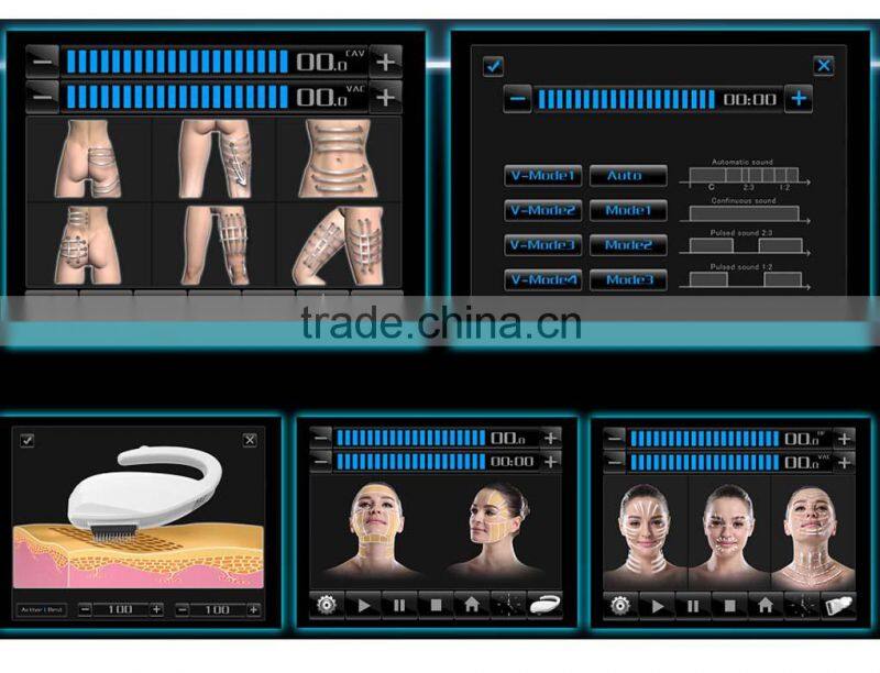 2014 Cavitation Weight Loss Ultrasound Body Beauty Equipment