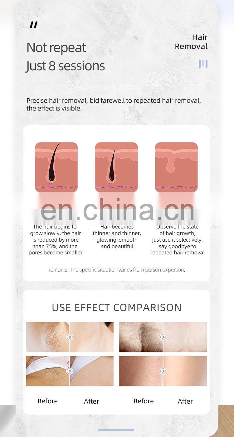 755nm picosecond laser tattoo removal 808 nm diode laser hair removal machine