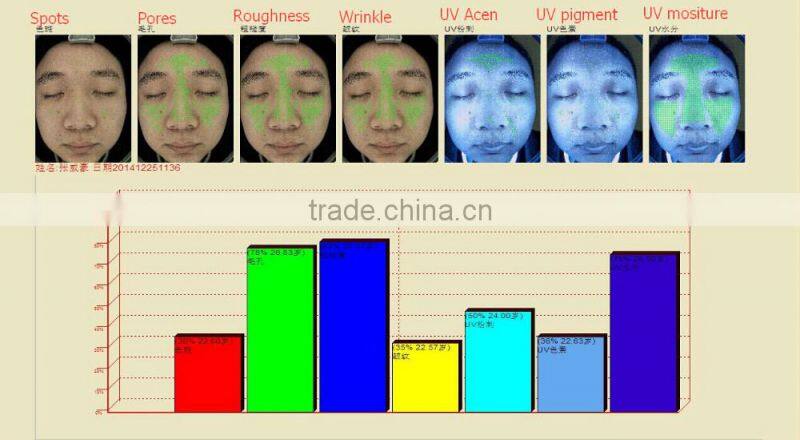 AYJ-J009(CE)2016 Hot sale New Portable skin and hair analyzer system/skin analysis machine