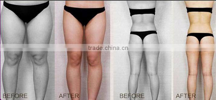 New arrival CE certificated Face Wrinkle Removal Liposonix Hifu/hifu Body Slimming Machine for beauty use