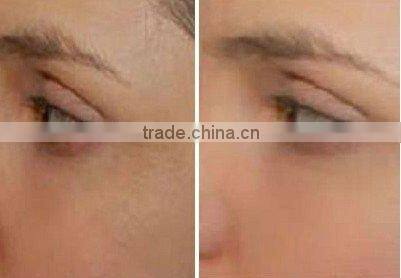 oxygen jet beauty instrument