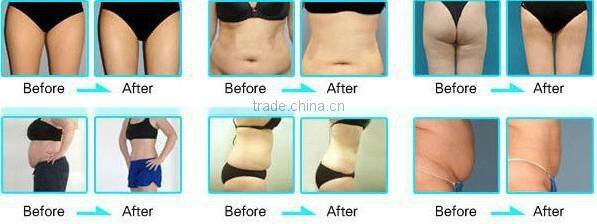 Cool slim therapy body sculpting machine