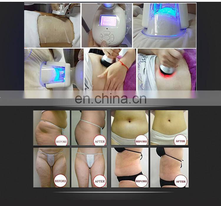 6 Handles cryolipolysis weight loss machine/Cool tech Fat Freezing slimming machine home device