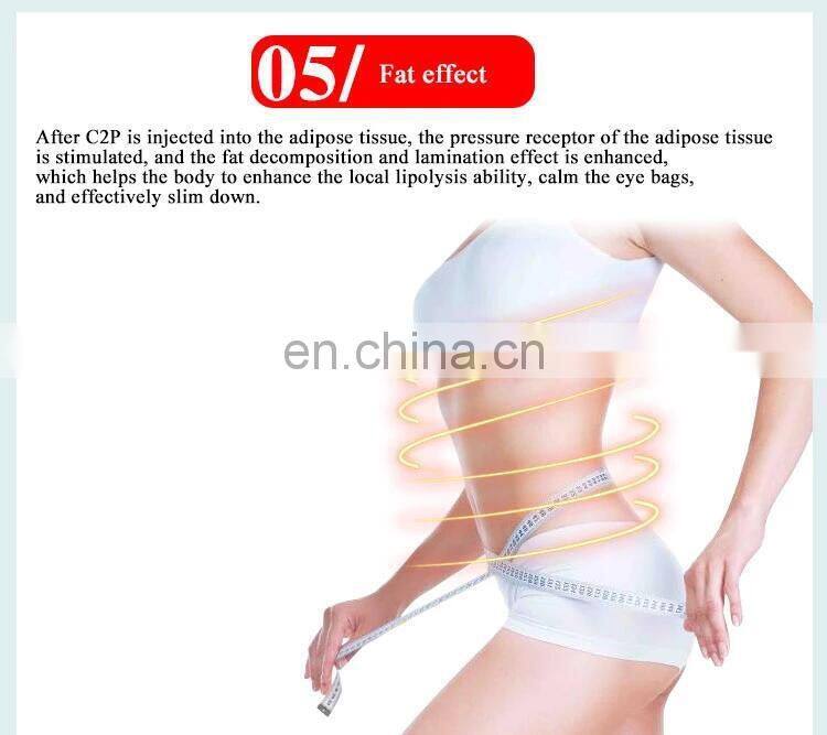 Hot Sale CDT carboxytherapy machine/carboxytherapy/carboxy therapy equipment