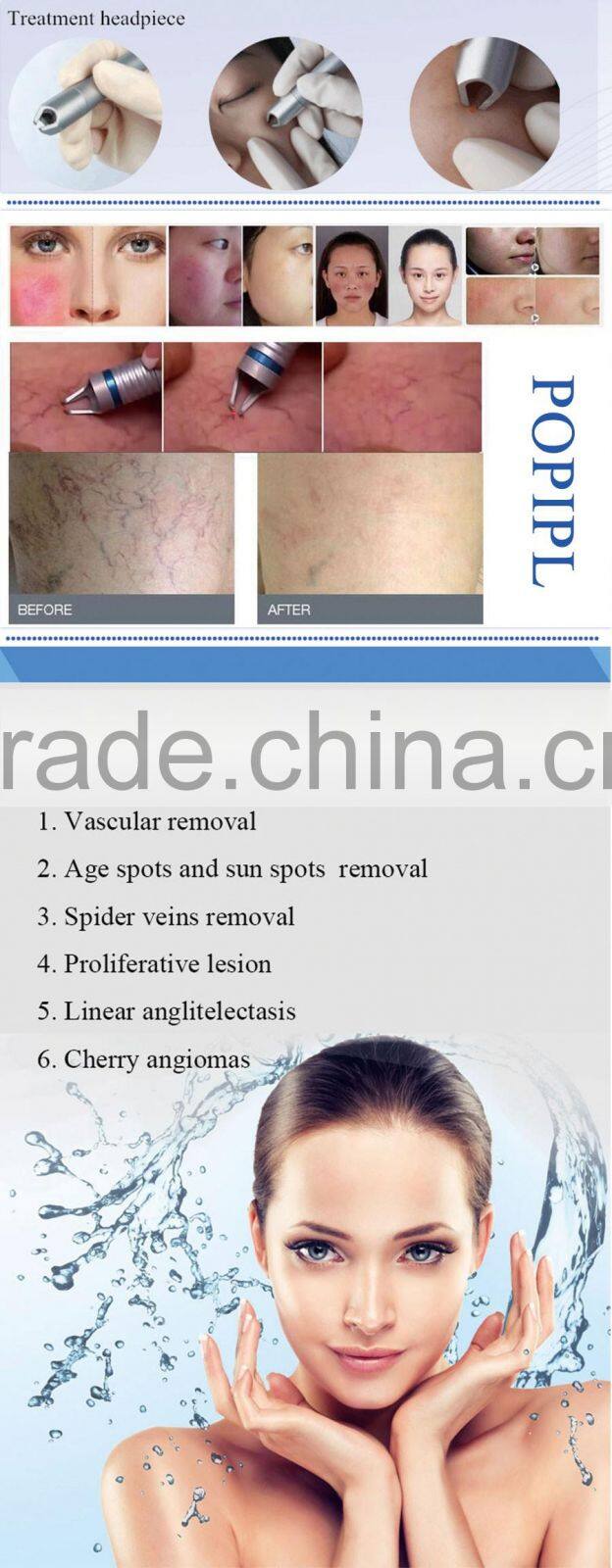 POPIPL MACHINE 20W 980nm laser vascular removal machine/ Beauty equipment 980 laser NEW!!!/ Blood vessel removal laser 2016new