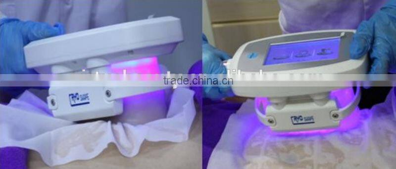 portable cryo lipolysis fat freezing/body cool sculpting weight loss equipment