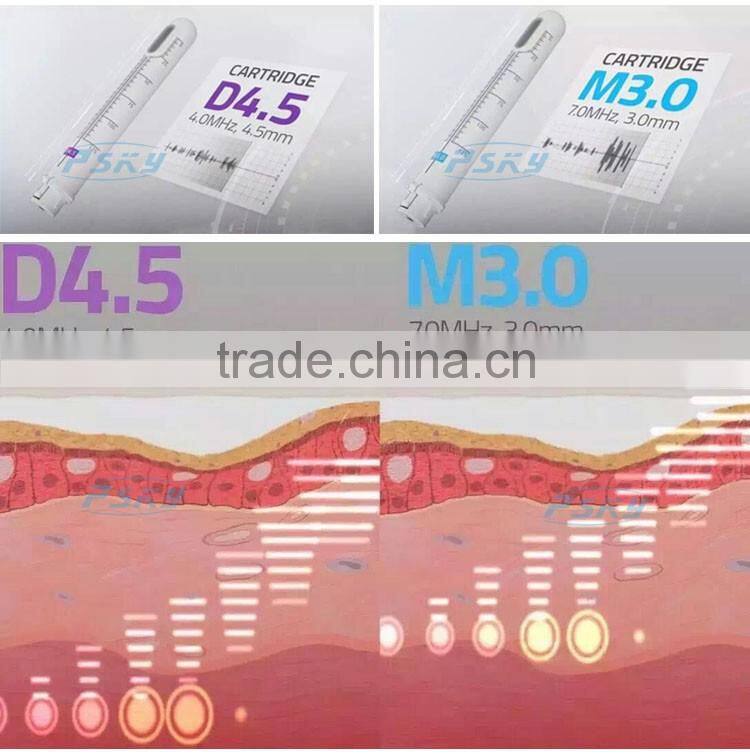 10000 shots woman painless vaginal rejuvenation HIFU machine for sale