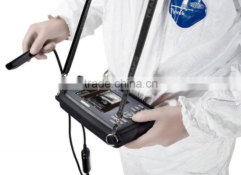 2016 Best Palm handheld ultrasound scanner ultrasound & palm ultrasound ultrasonic diagnostic insturements-V8