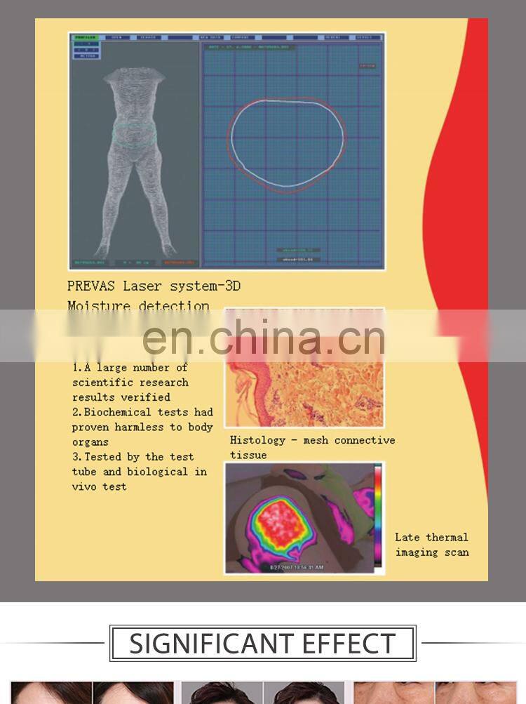 portable slimming machine rf skin tightening machine for sale