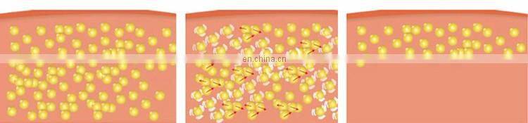 hot sale rf fast vacuum cavitation kim 8 slimming system