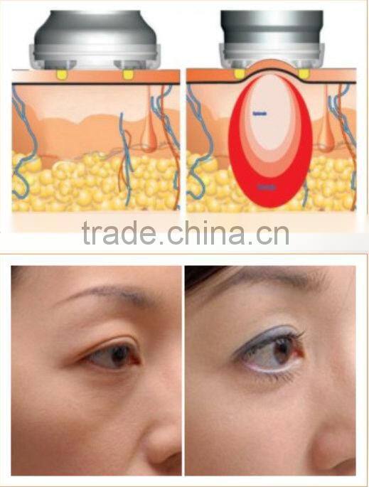 Home Use Multi-polar RF Salon Beauty Machine Radio Frequency L-81