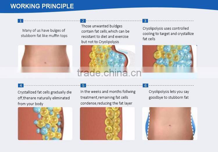 Factory direct sales fat freezing best cryolipolysis machine with better result